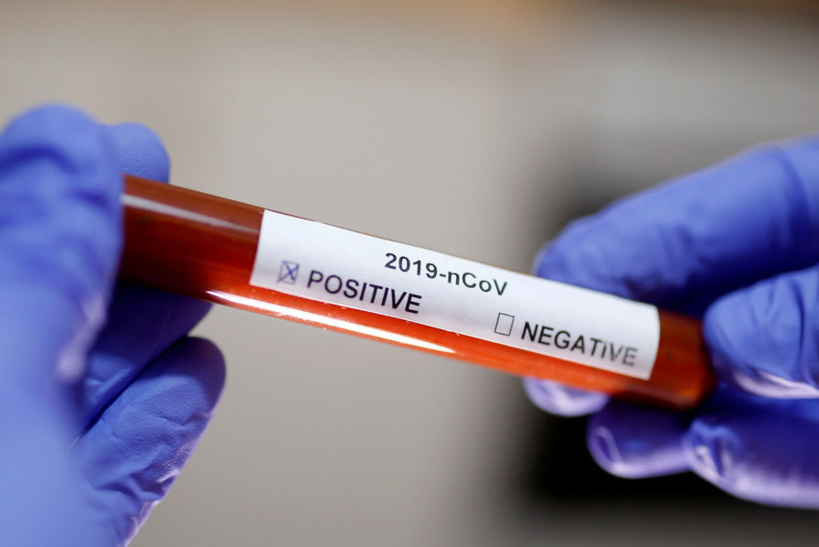 Coronavirus, Mercredi 12 Mai 2021: 1 décès, 33 nouveaux cas, 12 graves